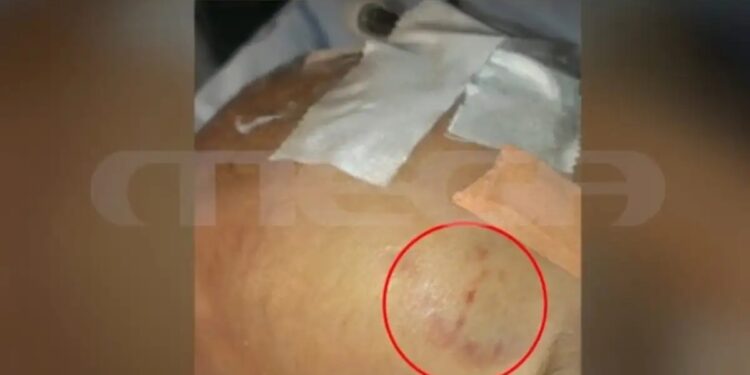 Alldaynews.gr «Για τον θάνατό του υποψιάζομαι την μάνα, την πρώην ή την πεθερά μου» λέει ο πατέρας του 2,5 μηνών βρέφους