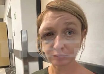 «Έχουμε σχέση αγάπης με τον σύντροφό μου» λέει η 40χρονη που ξυλοκοπήθηκε άγρια – Συγκλονίζει η εικόνα της μετά την κακοποίηση