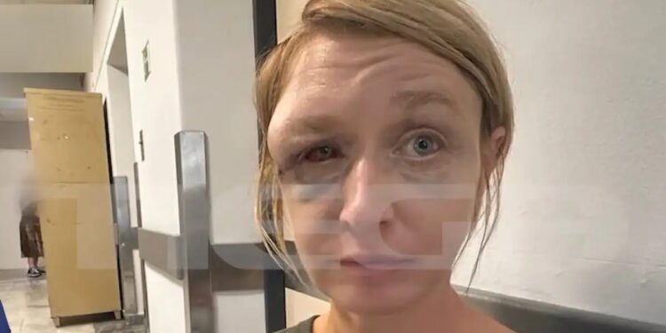 Alldaynews.gr «Έχουμε σχέση αγάπης με τον σύντροφό μου» λέει η 40χρονη που ξυλοκοπήθηκε άγρια – Συγκλονίζει η εικόνα της μετά την κακοποίηση