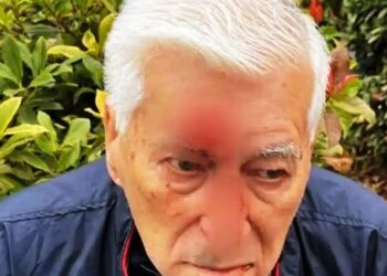 Alldaynews.gr Λιπώδες ήπαρ: Το διατροφικό πλάνο που “καίει” το λίπος στο συκώτι και βοηθά σε ταχεία απώλεια βάρους