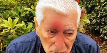 Alldaynews.gr Λιπώδες ήπαρ: Το διατροφικό πλάνο που “καίει” το λίπος στο συκώτι και βοηθά σε ταχεία απώλεια βάρους