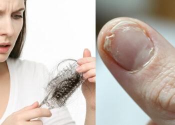 Xρειάζεται να φάτε αυτό αν έχετε απώλεια μαλλιών, εύθραυστα νύχια ή αν δεν κοιμάστε καλά (ΦΩΤΟ)