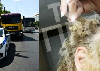 Γνωστός πλαστικός χειρουργός ξυλοκόπησε 43χρονη στη μέση της Συγγρού: Της ξερίζωσε τα μαλλιά και την χτύπησε στο κεφάλι