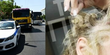 Alldaynews.gr Γνωστός πλαστικός χειρουργός ξυλοκόπησε 43χρονη στη μέση της Συγγρού: Της ξερίζωσε τα μαλλιά και την χτύπησε στο κεφάλι