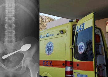 Alldaynews.gr Απίστευτο περιστατικό: 25χρονη κατάπιε κουτάλι – Εσπευσμένα στο Νοσοκομείο συνοδεία συγγενών