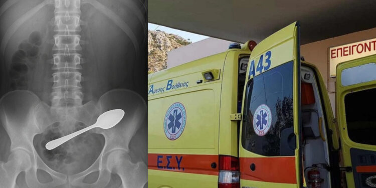 Απίστευτο περιστατικό: 25χρονη κατάπιε κουτάλι – Εσπευσμένα στο Νοσοκομείο συνοδεία συγγενών