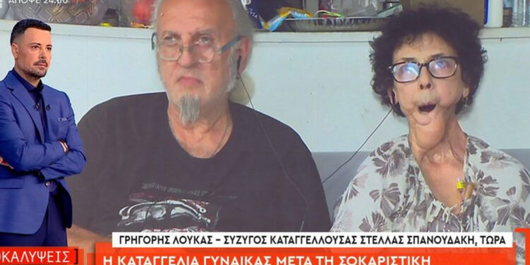 Alldaynews.gr Καταγγελία για γιατρό σε ελληνικό Νοσοκομείο: Παραμόρφωσε γυναίκα που νίκησε καρκίνο στη γλώσσα – Δεν μπορεί να μιλήσει ή να φάει