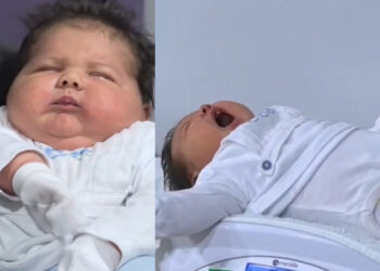 Νεογέννητο 6 κιλά και 150 γραμμάρια με ύψος 59 εκατοστά προκαλεί έκπληξη στους γιατρούς