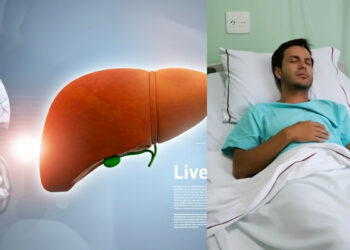 Λιπώδες ήπαρ: Το διατροφικό πλάνο που “καίει” το λίπος στο συκώτι και βοηθά σε ταχεία απώλεια βάρους