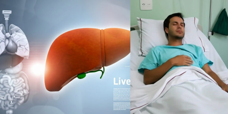 Λιπώδες ήπαρ: Το διατροφικό πλάνο που “καίει” το λίπος στο συκώτι και βοηθά σε ταχεία απώλεια βάρους