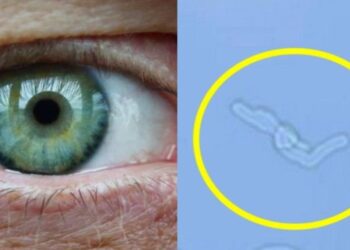Βλέπεις μυγάκια, κηλίδες ή τριχίτσες στα μάτια σου; Γιατί εμφανίζονται – Πότε πρέπει να επισκεφτείς οφθαλμίατρο
