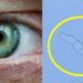 Βλέπεις μυγάκια, κηλίδες ή τριχίτσες στα μάτια σου; Γιατί εμφανίζονται – Πότε πρέπει να επισκεφτείς οφθαλμίατρο