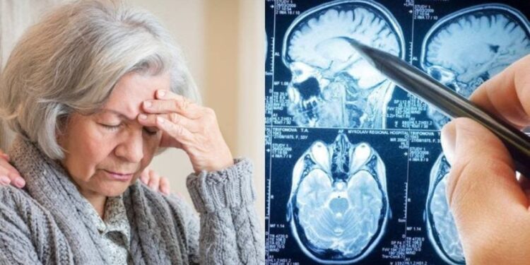 Alldaynews.gr Άνοια: Η πασiγνωστη βιταμiνη που σώζει το μυαλό