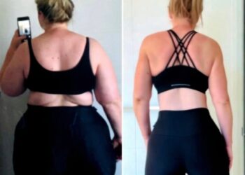 Γυναίκα που έχασε πάνω από 70 κιλά μοιράζεται την απλή άσκηση που την βοήθησε στην απώλεια βάρους – «Αξίζει να την δοκιμάσετε»