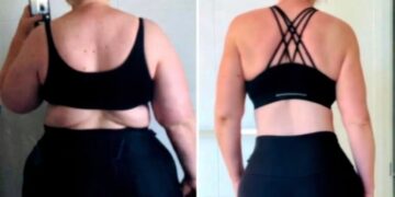 Γυναίκα που έχασε πάνω από 70 κιλά μοιράζεται την απλή άσκηση που την βοήθησε στην απώλεια βάρους – «Αξίζει να την δοκιμάσετε»