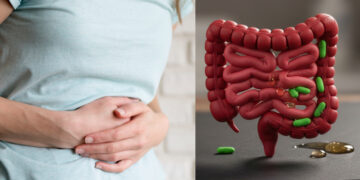 Εκκολπώματα εντέρου: Αυτές οι τροφές καλύτερα να μένουν εκτός πιάτου το ερεθίζουν και πρέπει να τις κόψετε