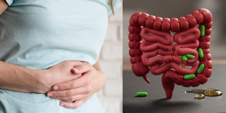 Εκκολπώματα εντέρου: Αυτές οι τροφές καλύτερα να μένουν εκτός πιάτου το ερεθίζουν και πρέπει να τις κόψετε