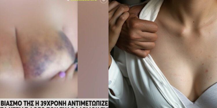 Δασκάλα 39 ετών κατήγγειλε ότι τη βίασαν ομαδικά τρεις άνδρες – Ο ηχογραφημένος διάλογος που «καίει» τους δράστες