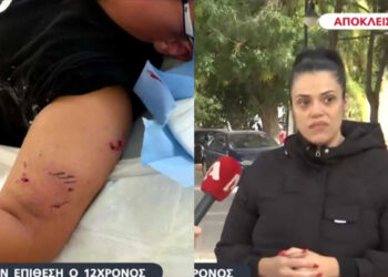 Σκύλος δάγκωσε 12χρονο έξω από Δημοτικό Σχολείο – Τι κατήγγειλε η μητέρα του για τον ιδιοκτήτη;