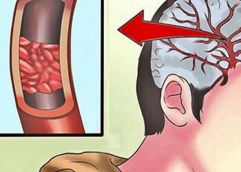 12 Σημάδια ότι χρειάζεστε περισσότερο Μαγνήσιο – Μην τα αγνοήσετε