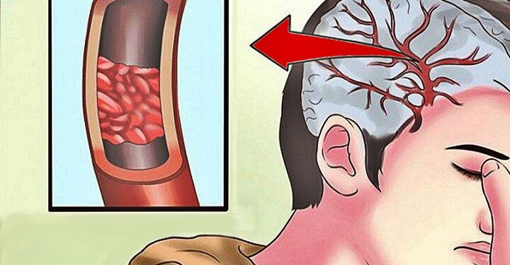 12 Σημάδια ότι χρειάζεστε περισσότερο Μαγνήσιο – Μην τα αγνοήσετε
