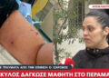 Alldaynews.gr Σκύλος δάγκωσε 12χρονο έξω από σχολείο στο Πέραμα – Τι κατήγγειλε η μητέρα του για τον ιδιοκτήτη;