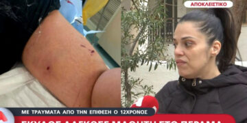 Alldaynews.gr Σκύλος δάγκωσε 12χρονο έξω από σχολείο στο Πέραμα – Τι κατήγγειλε η μητέρα του για τον ιδιοκτήτη;