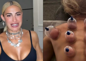 Η Ιωάννα Τούνη έκανε πρώτη φορά βεντούζες (video)