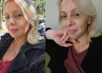 Πάλευα με λεύκη και καρκίνο ενώ μεγάλωνα μόνη 4 παιδιά. Ώσπου έβγαλα τα «σκουπίδια» από τη ζωή μου