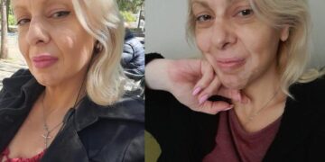 Πάλευα με λεύκη και καρκίνο ενώ μεγάλωνα μόνη 4 παιδιά. Ώσπου έβγαλα τα «σκουπίδια» από τη ζωή μου