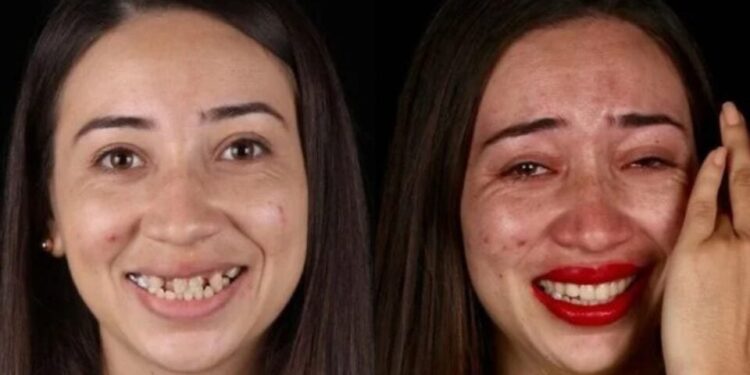 Μοιράζει χαμόγελα ευτυχίας: Οδοντίατρος φτιάχνει δωρεάν τα δόντια φτωχών ανθρώπων και τους αλλάζει τη ζωή