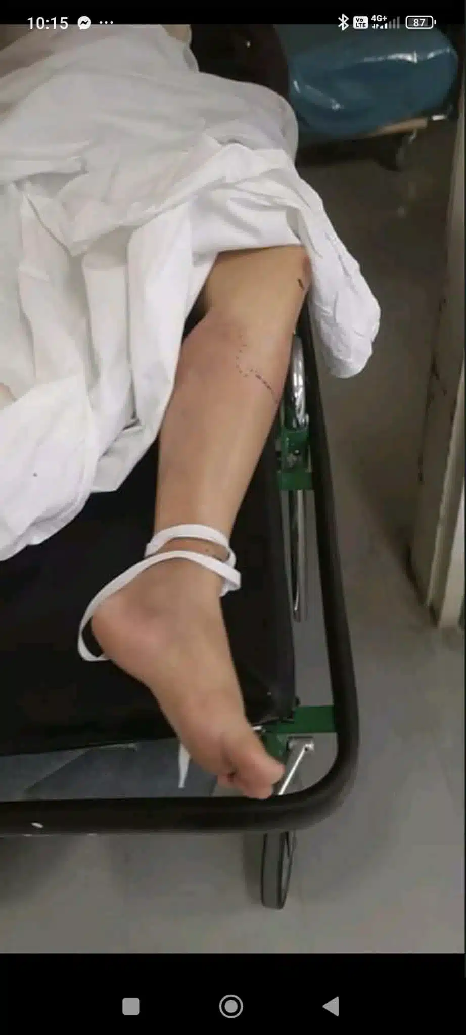 Γυναίκα 38 ετών πέθανε από σηψαιμία στις αιμορροΐδες λίγες ημέρες αφού γέννησε 1 89911ff0 325a 4f31 96ee d70daeb9d755.jpg