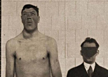 Η ιστορία του νάνου που έγινε γίγαντας: Στα 18 του είχε ύψος 1,22μ. και πέθανε στα 2,34μ.