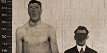 Alldaynews.gr Η ιστορία του νάνου που έγινε γίγαντας: Στα 18 του είχε ύψος 1,22μ. και πέθανε στα 2,34μ.