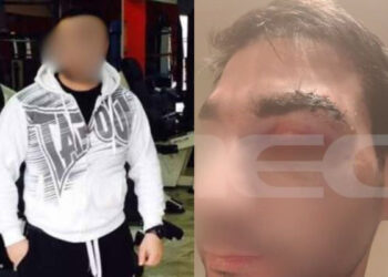 ΕΚΤΑΚΤΟ: Νεκρός ο μποξέρ που ξυλοκόπησε τον γιατρό μέσα στο νοσοκομείο (video)