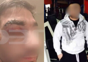 Πέθανε ο 43χρονος ασθενής μποξέρ που γρονθοκόπησε γιατρό – Τι λέει ο ορθοπεδικός για την επίθεση (video)