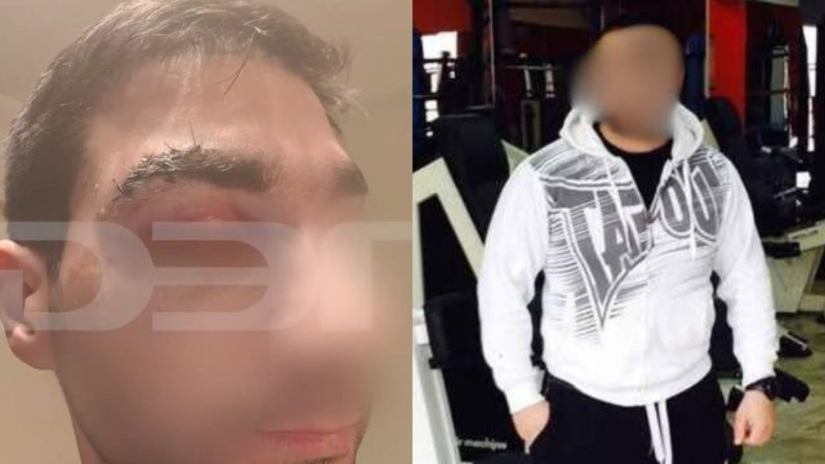 Alldaynews.gr Πέθανε ο 43χρονος ασθενής μποξέρ που γρονθοκόπησε γιατρό – Τι λέει ο ορθοπεδικός για την επίθεση (video)