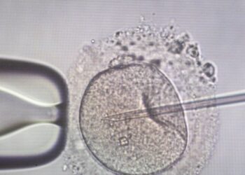 Συναγερμός – Βρέθηκε καρκινικό γονίδιο σε σπέρμα δότη γνωστής Τράπεζας σπέρματος: Βρέθηκαν μέχρι τώρα 197 παιδιά – Κάποια ήδη πέθαναν