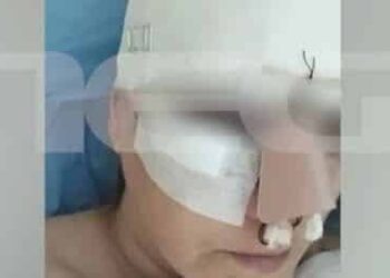 Εμπορικό Κέντρο Θεσσαλονίκης: «Σπασμένη μύτη, πλευρό, πάνω από 100 ράμματα»