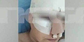 Εμπορικό Κέντρο Θεσσαλονίκης: «Σπασμένη μύτη, πλευρό, πάνω από 100 ράμματα»