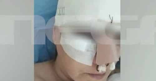 Εμπορικό Κέντρο Θεσσαλονίκης: «Σπασμένη μύτη, πλευρό, πάνω από 100 ράμματα»