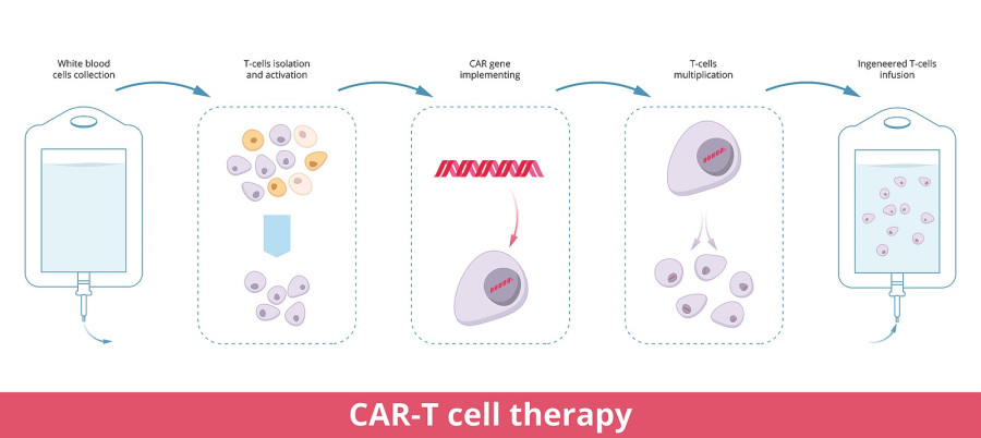 Car-t Cell Therapy
