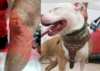 Αδιανόητο: Νεαρός έβαλε το πίτμπουλ του να επιτεθεί σε 30χρονο για να τον ληστέψει – «Με έριξε κάτω και το σκυλί με δάγκωνε» (video)