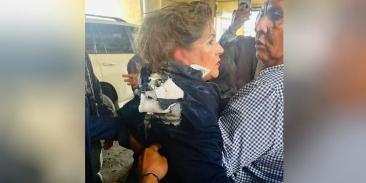 Alldaynews.gr Ρούτσι