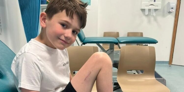 9χρονος υποβλήθηκε στην πρώτη επέμβαση για αύξηση ύψους λόγω σπάνιας πάθησης