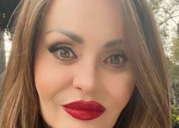 Παραμορφώθηκε από την πλαστικές, μοιάζει ψεύτικη: Την θυμάστε; 26 χρόνια μετά, δεν την αναγνωρίζει κανείς