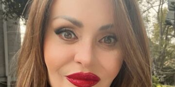 Παραμορφώθηκε από την πλαστικές, μοιάζει ψεύτικη: Την θυμάστε; 26 χρόνια μετά, δεν την αναγνωρίζει κανείς