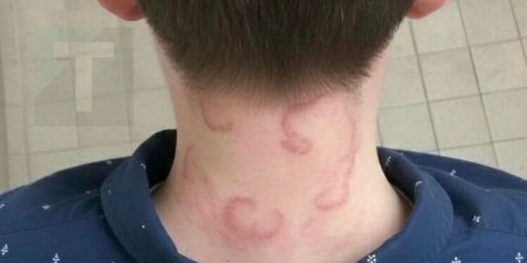 Ο 8χρονος γιος μου έχει αυτό εδώ και 2 μήνες συνεχόμενα και έχει χειροτερέψει από την πρώτη φορά που το είχε… Τι είναι;