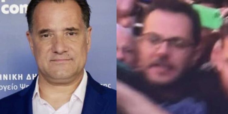 Άδωνις Γεωργιάδης: «Ο “καλός” και “αδικημένος” γιατρός από τη Νίκαια ήθελε απόδειξη ότι με κτύπησε, δείτε τη γροθιά του»