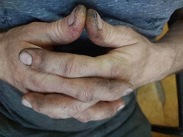 Τι πραγματικά λένε τα βρώμικα νύχια για έναν άνθρωπο; 3 1 4